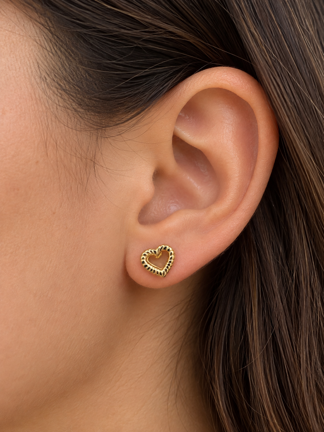 Aretes Ortopédicos